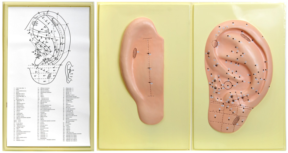 Схема Аурикулотерапии Для Снижения Веса