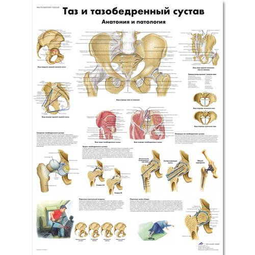 ZVR6172L Таз и тазобедренный сустав, анатомия и патология,  плакат 50х67 см