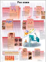 ZVR6295L ��� ����