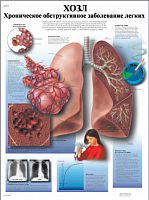 ZVR6329L ����������� ������������� ����������� ������