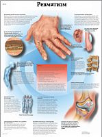 ZVR6124L ���������